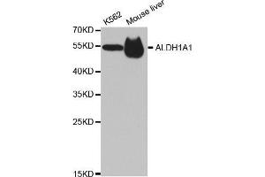 Western blot analysis of extracts of various cell lines, using ALDH1A1 antibody.