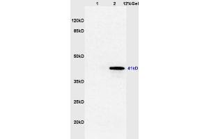 Lane 1: mouse brain lysates Lane 2: mouse thyroid lysates probed with Anti TTF-2/FOXE1 Polyclonal Antibody, Unconjugated (ABIN668721) at 1:200 in 4 °C. (FOXE1 antibody  (AA 101-200))