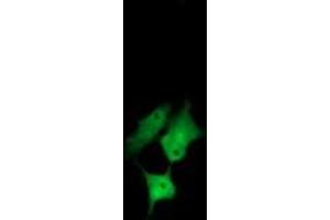 Image no. 2 for anti-Chaperonin Containing TCP1, Subunit 8 (Theta)-Like 2 (CCT8L2) antibody (ABIN1497480) (CCT8L2 antibody)
