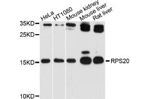 Western blot analysis of extracts of various cell lines, using RPS20 antibody (ABIN4905052) at 1:1000 dilution. (RPS20 antibody)