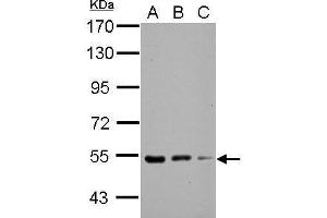 WB Image Sample (30 ug of whole cell lysate) A: NIH-3T3 B: JC C: BCL-1 7. (KBTBD4 antibody  (Center))