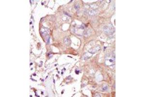 Image no. 2 for anti-Mitogen-Activated Protein Kinase Kinase Kinase Kinase 3 (MAP4K3) (C-Term) antibody (ABIN360428)