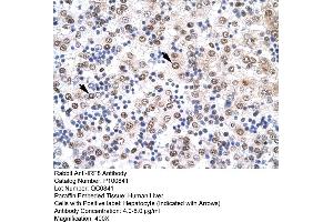 Immunohistochemistry with Human Liver cell lysate tissue (IRF8 antibody  (N-Term))