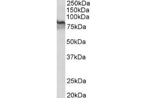 Image no. 1 for anti-Transglutaminase 2 (C Polypeptide, Protein-Glutamine-gamma-Glutamyltransferase) (TGM2) (AA 578-591) antibody (ABIN1104653) (Transglutaminase 2 antibody  (AA 578-591))