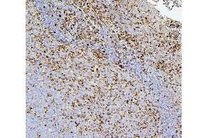 IHC analysis of CD43 using anti-CD43 antibody (ABIN7601042). (CD43 antibody  (AA 272-400))