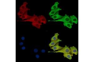 KIR3DL2 Antibody staining Hela cells by IF/ICC.