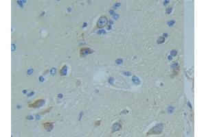 Immunohistochemistry (IHC) image for anti-Tumor Necrosis Factor Receptor Superfamily, Member 1A (TNFRSF1A) (AA 248-428) antibody (ABIN7442288)