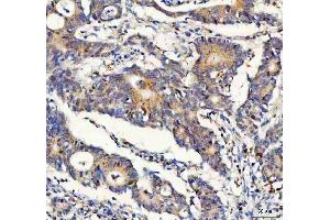 IHC analysis of FOXO3A using anti-FOXO3A antibody (ABIN3042404). (FOXO3 antibody  (AA 471-673))