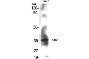 Western Blot (WB) analysis of specific cells using AIM2 Polyclonal Antibody. (AIM2 antibody  (Internal Region))
