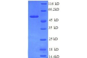 Protein expressed in E. (Hemopexin Protein (HPX) (AA 24-460, full length) (His tag))