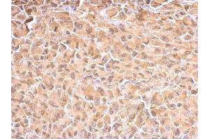 IHC-P Image HSP70 1A antibody detects HSPA1A protein at cytosol on H1299 xenograft by immunohistochemical analysis. (HSP70 1A antibody  (Center))