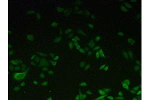 IHC-P analysis of Human HeLa cells, with FITC staining.