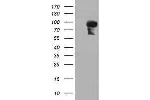 Western Blotting (WB) image for anti-phosphoinositide-3-Kinase Adaptor Protein 1 (PIK3AP1) antibody (ABIN1496825) (PIK3AP1 antibody)