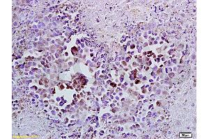 Formalin-fixed and paraffin embedded mouse lymphoma tissue labeled with Anti-Cyclin A2 Polyclonal Antibody (ABIN670281), Unconjugated at 1:100, followed by conjugation to the secondary antibody and DAB staining (Cyclin A antibody  (AA 375-431))