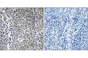 Immunohistochemistry analysis of paraffin-embedded human tonsil tissue, using RPL23 Antibody.