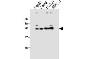 All lanes : Anti-GSTA1 Antibody at 1:4000 dilution Lane 1: HepG2 whole cell lysate Lane 2: Caco2 whole cell lysate Lane 3: LNCaP whole cell lysate Lane 4: NC-1 whole cell lysate Lysates/proteins at 20 μg per lane.