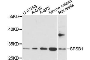 Western blot analysis of extracts of various cell lines, using SPSB1 antibody (ABIN6293888) at 1:1000 dilution. (SPSB1 antibody)
