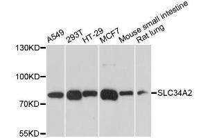 Western blot analysis of extracts of various cell lines, using SLC34A2 antibody. (SLC34A2 antibody)