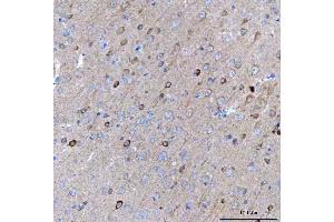 IHC analysis of BCAT1 using anti-BCAT1 antibody (ABIN7602594). (BCAT1 antibody  (AA 88-386))