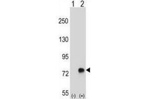 Western blot analysis of TGFBI (arrow) using rabbit polyclonal TGFBI Antibody (N-term) .
