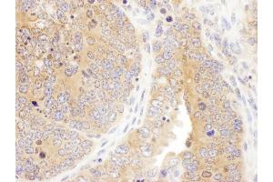 Immunohistochemistry (IHC) image for anti-Septin 7 (SEPT7) (AA 387-437) antibody (ABIN7455012) (Septin 7 antibody  (AA 387-437))