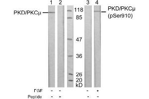 Image no. 1 for anti-Protein Kinase D1 (PRKD1) (pSer910) antibody (ABIN196784) (PKC mu antibody  (pSer910))