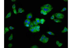 Immunofluorescence staining of HepG2 cells with ABIN7168811 at 1:400, counter-stained with DAPI. (SEMA5A antibody  (AA 201-400))