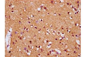 IHC image of ABIN7154582 diluted at 1:200 and staining in paraffin-embedded human brain tissue performed on a Leica BondTM system. (DIRAS1 antibody  (AA 1-195))