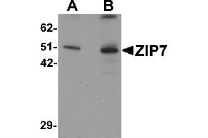 Western Blotting (WB) image for anti-Solute Carrier Family 39 (Zinc Transporter), Member 7 (SLC39A7) (N-Term) antibody (ABIN1031683) (SLC39A7 antibody  (N-Term))