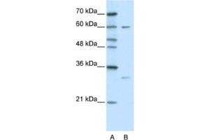 Western Blotting (WB) image for anti-Zinc Finger Protein 395 (ZNF395) antibody (ABIN2460665) (ZNF395 antibody)