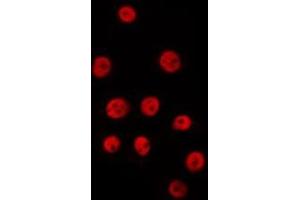 ABIN6278212 staining HepG2 by IF/ICC. (XPO4 antibody  (N-Term))