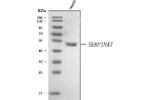 Western blot analysis of Thyroxine Binding Globulin/SERPINA7 using anti-Thyroxine Binding Globulin/SERPINA7 antibody (ABIN7602019). (SERPINA7 antibody  (AA 55-389))