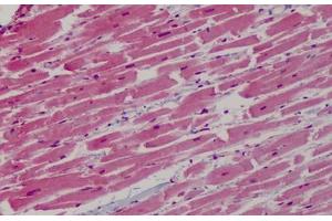 Human Heart: Formalin-Fixed, Paraffin-Embedded (FFPE) (GP1BB antibody  (AA 56-118))