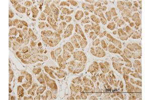Immunoperoxidase of monoclonal antibody to NDUFA5 on formalin-fixed paraffin-embedded human heart.