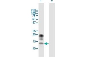 Western Blot analysis of KCNE1 expression in transfected 293T cell line by KCNE1 MaxPab polyclonal antibody. (KCNE1 antibody  (AA 1-129))