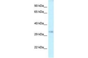 Image no. 1 for anti-Septin 12 (Sep12) (AA 100-149) antibody (ABIN6747671) (Septin 12 antibody  (AA 100-149))