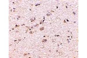 Immunohistochemistry (IHC) image for anti-Discs, Large (Drosophila) Homolog-Associated Protein 1 (DLGAP1) (Middle Region) antibody (ABIN1031076) (DLGAP1 antibody  (Middle Region))