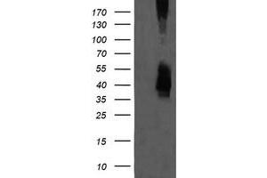 Image no. 1 for anti-Mitogen-Activated Protein Kinase Kinase 3 (MAP2K3) antibody (ABIN1499419) (MAP2K3 antibody)