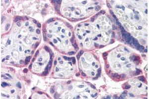 Human Placenta (formalin-fixed, paraffin-embedded) stained with ATG16L1 antibody ABIN351447 at 5 ug/ml followed by biotinylated goat anti-rabbit IgG secondary antibody ABIN481713, alkaline phosphatase-streptavidin and chromogen. (ATG16L1 antibody  (Internal Region))