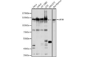 Western blot analysis of extracts of various cell lines, using eIF3B antibody (ABIN6130364, ABIN6140053, ABIN6140054 and ABIN6214441) at 1:1000 dilution.