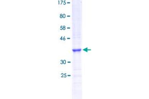 KDM5D Protein (AA 127-230) (GST tag)