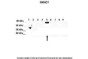 Lanes:   Lane 1: 5ug of transfected 293T lysate (SMAD1)  Lane 1: 5ug of transfected 293T lysate (SMAD2)  Lane 1: 5ug of transfected 293T lysate (SMAD3)  Lane 1: 5ug of transfected 293T lysate (SMAD4)  Lane 1: 5ug of transfected 293T lysate (SMAD5)  Lane 1: 5ug of transfected 293T lysate (SMAD6)  Lane 1: 5ug of transfected 293T lysate (SMAD7)  Lane 1: 5ug of transfected 293T lysate (SMAD8)  Lane 1: 5ug of transfected 293T lysate (GFP)  Primary Antibody Dilution:   1:1000  Secondary Antibody:   Goat anti-Rabbit IgG HRP Conjugated  Secondary Antibody Dilution:   1:10,000  Gene Name:   SMAD5  Submitted by:   Amanda Urick, Medical College of Wisconsin (SMAD5 antibody  (Middle Region))