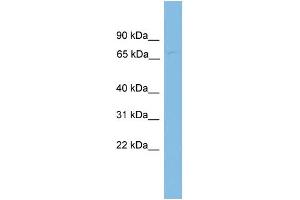 WB Suggested Anti-FBXL4 Antibody Titration: 0. (FBXL4 antibody  (N-Term))