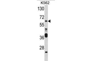 Western blot analysis of PAX3 Antibody (N-term) in K562 cell line lysates (35ug/lane). (Paired Box 3 antibody  (N-Term))