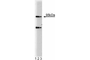 Western blot analysis of Villin on HCT-8 lysate. (Villin 1 antibody  (AA 1-827))