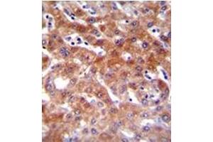Formalin fixed, paraffin embedded Human liver tissue stained with CYP1A2 Antibody (Center) followed by peroxidase conjugation of the secondary antibody and DAB staining.