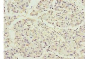 Immunohistochemistry of paraffin-embedded human pancreatic tissue using ABIN7150518 at dilution of 1:100 (DNAJB2 antibody  (AA 215-324))