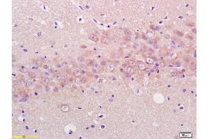 Formalin-fixed and paraffin embedded rat brain labeled with Anti ENO3 Polyclonal Antibody (ABIN752038), Unconjugated at 1:200, followed by conjugation to the secondary antibody and DAB staining (ENO3 antibody  (AA 341-434))