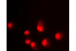 Immunofluorescence (IF) image for anti-Mdm2, p53 E3 Ubiquitin Protein Ligase Homolog (Mouse) (MDM2) (C-Term) antibody (ABIN7296282)