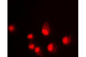 Immunofluorescent analysis of MDM2 staining in Jurkat cells. (MDM2 antibody  (C-Term))